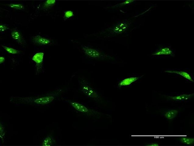 Anti-IFRD2 antibody produced in rabbit