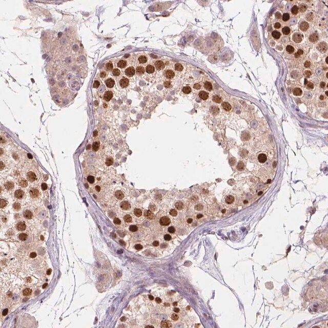 Anti-IFFO1 antibody produced in rabbit