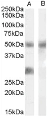 Anti-IGFBP3 antibody produced in goat