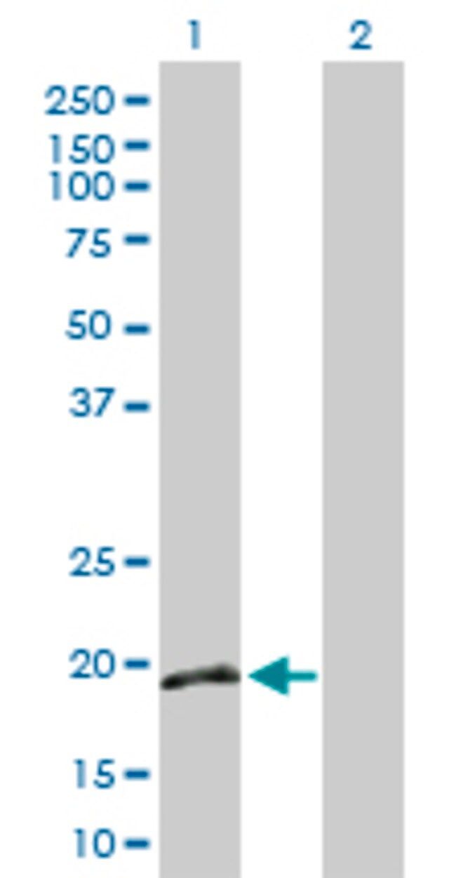 Anti-IFNA16 antibody produced in rabbit