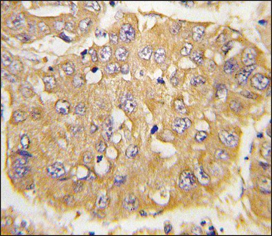 Anti-IGFBP3 (N-term) antibody produced in rabbit