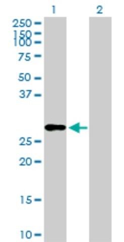 Anti-IGF2 antibody produced in rabbit