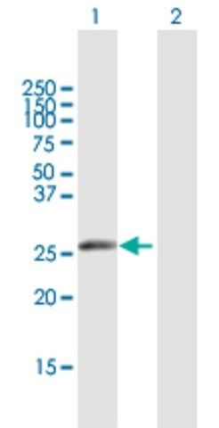 Anti-IGKV1-5 antibody produced in mouse