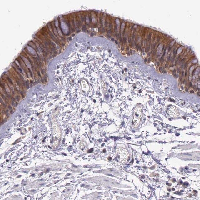 Anti-IGBP1 antibody produced in rabbit