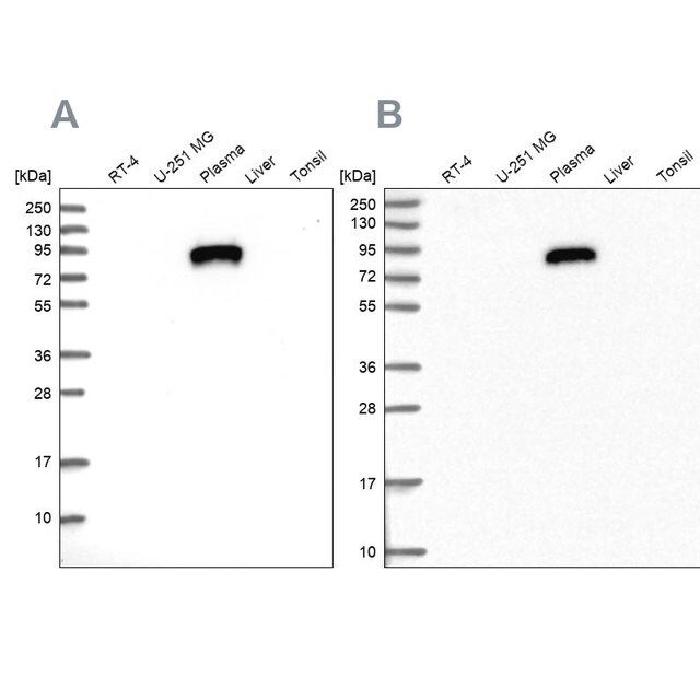 Anti-IGFALS antibody produced in rabbit