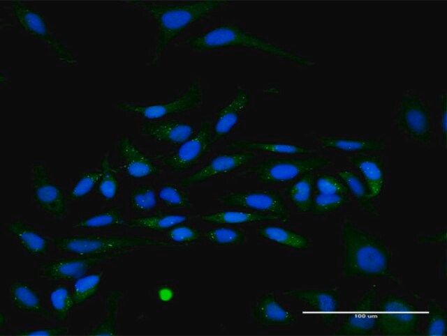 Anti-IFNA17 antibody produced in rabbit