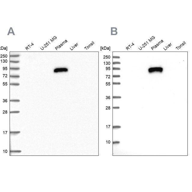 Anti-IGFALS antibody produced in rabbit