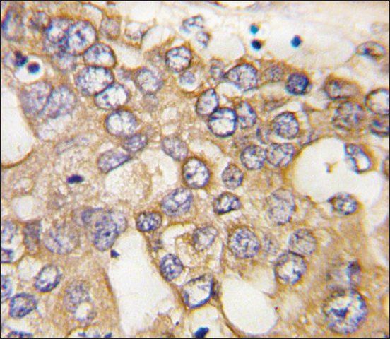 Anti-IGFBP3 (C-term) antibody produced in rabbit