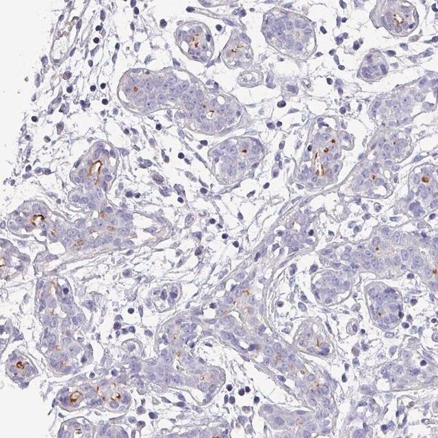 Anti-IGSF23 antibody produced in rabbit