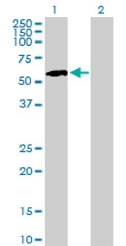 Anti-IHPK1 antibody produced in mouse