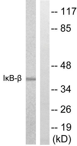 Anti-IB- antibody produced in rabbit