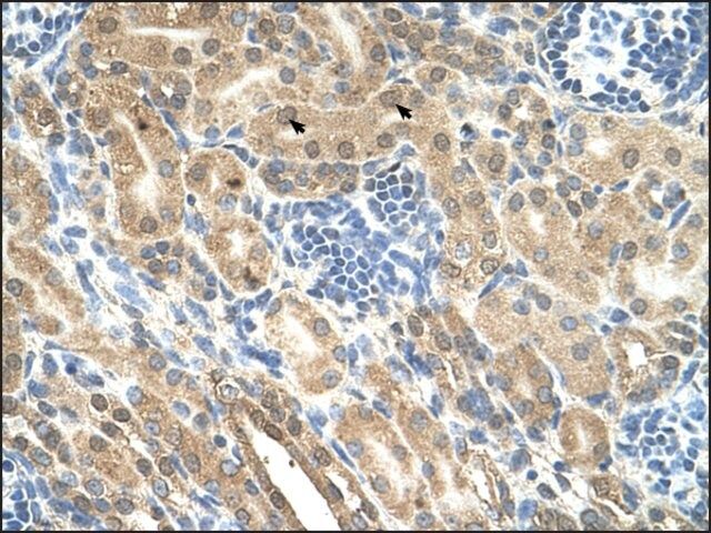 Anti-IHH antibody produced in rabbit