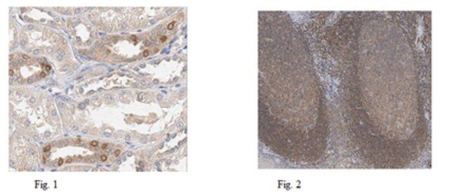 Anti-IKKa (p45) Antibody, clone 881H3