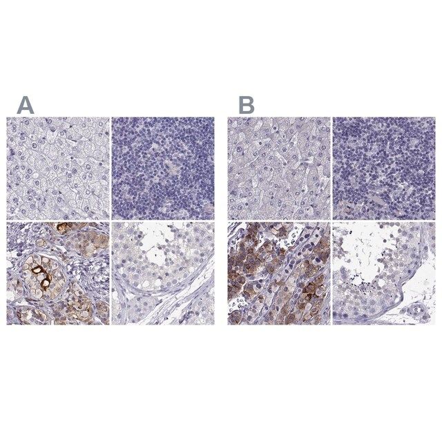 Anti-IGSF1 antibody produced in rabbit