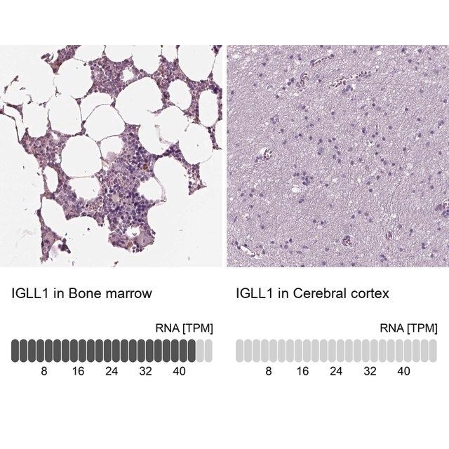 Anti-IGLL1 antibody produced in rabbit