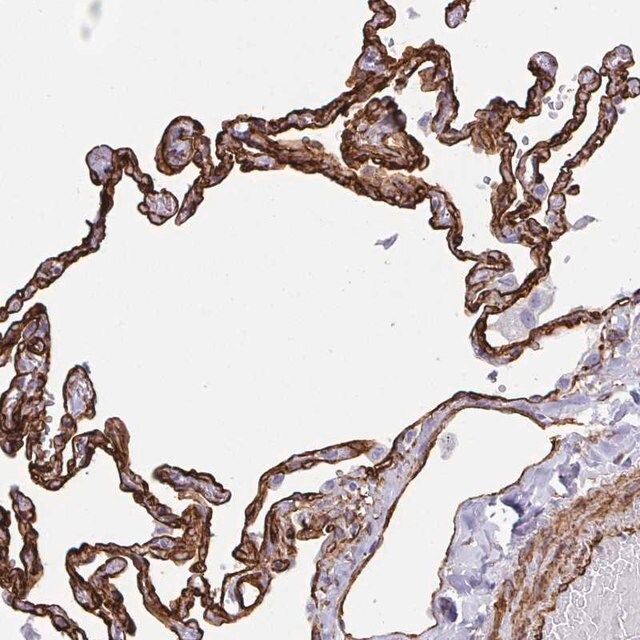 Anti-IGSF23 antibody produced in rabbit