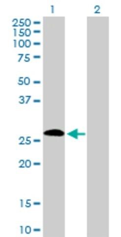 Anti-IGSF6 antibody produced in rabbit