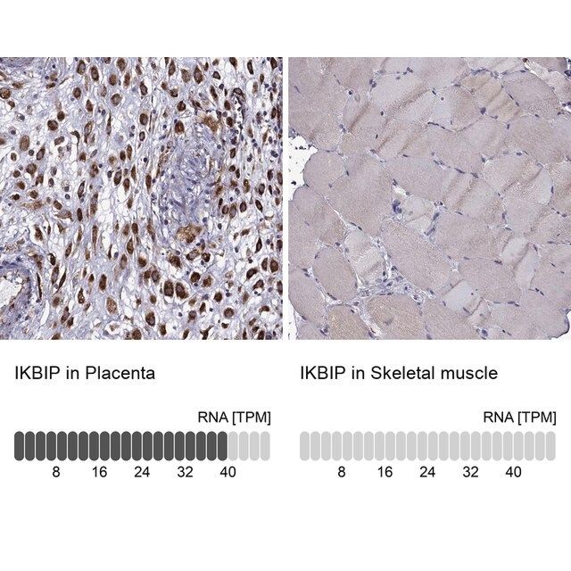 Anti-IKBIP antibody produced in rabbit