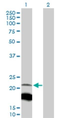 Anti-IGLL1 antibody produced in rabbit