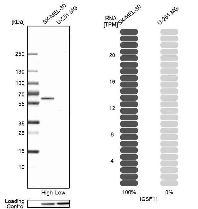 Anti-IGSF11 antibody produced in rabbit