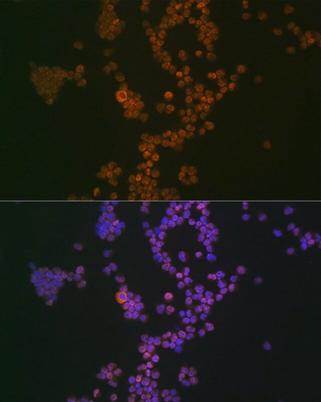 Anti-Ikaros antibody produced in rabbit