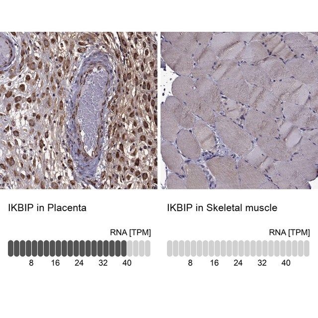 Anti-IKBIP antibody produced in rabbit