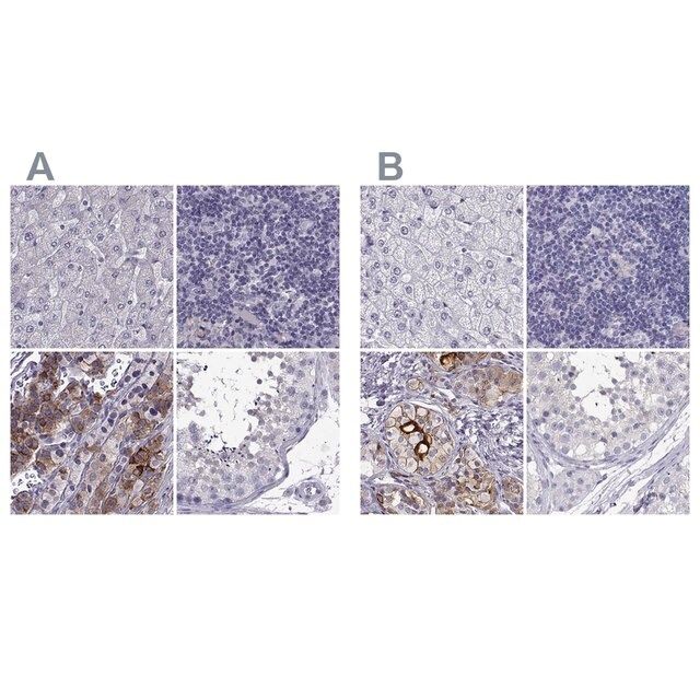 Anti-IGSF1 antibody produced in rabbit