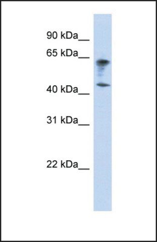 Anti-IGSF11 antibody produced in rabbit