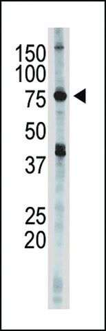 ANTI-IKK EPSILON (IKKE)(C-TERMINAL) antibody produced in rabbit