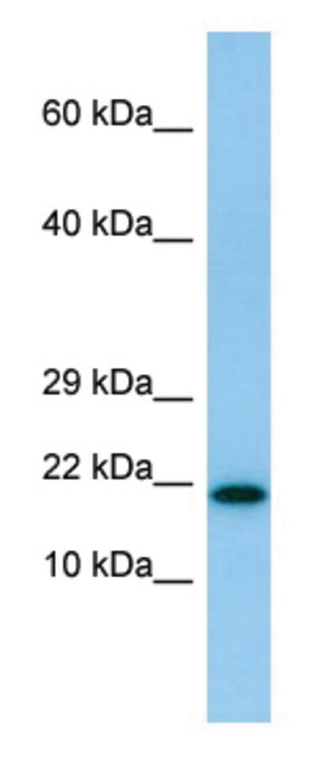 Anti-IL26 (N-terminal) antibody produced in rabbit