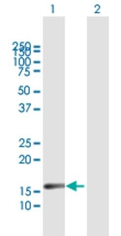 Anti-IL20 antibody produced in mouse