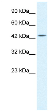 Anti-IKBKG antibody produced in rabbit