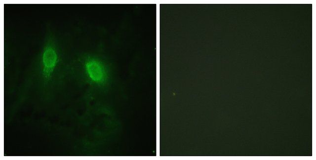 Anti-IKK- antibody produced in rabbit