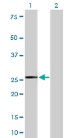 Anti-IGKC antibody produced in rabbit