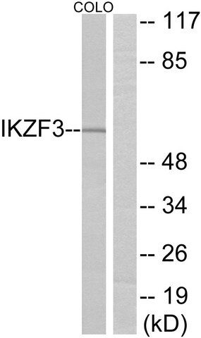 Anti-IKZF3 antibody produced in rabbit