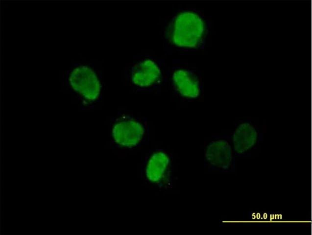 Anti-IHPK2 antibody produced in mouse