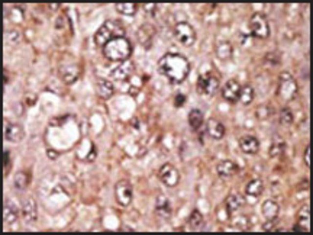 Anti-IL28 (center) antibody produced in rabbit