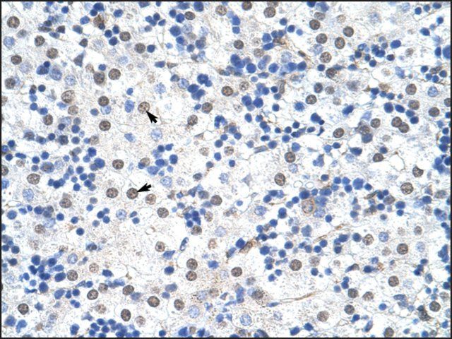 Anti-IKZF3 antibody produced in rabbit