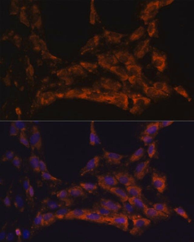 Anti-IL18 antibody produced in rabbit