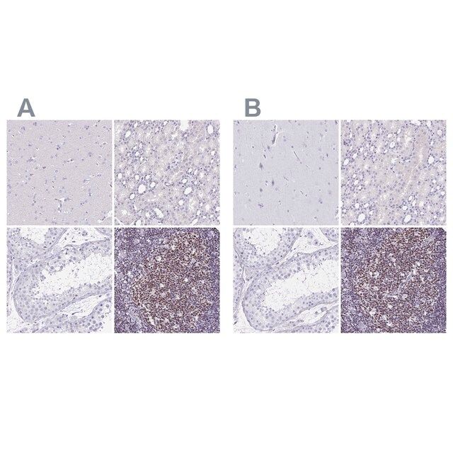 Anti-IKZF1 antibody produced in rabbit