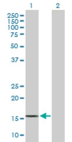 Anti-IL21 antibody produced in mouse