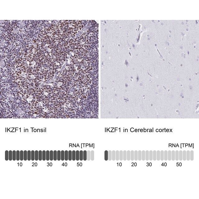 Anti-IKZF1 antibody produced in rabbit