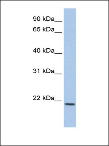 Anti-IL22 antibody produced in rabbit