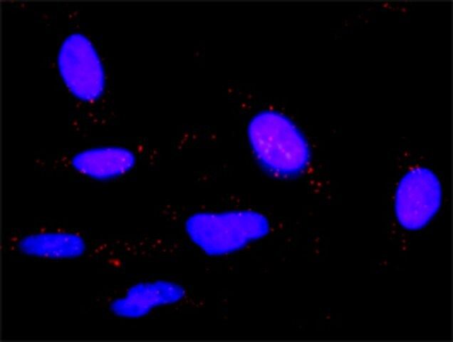 Anti-IL6 antibody produced in rabbit