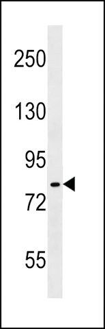 ANTI-IKK ALPHA/IKK BETA (CENTER) antibody produced in rabbit