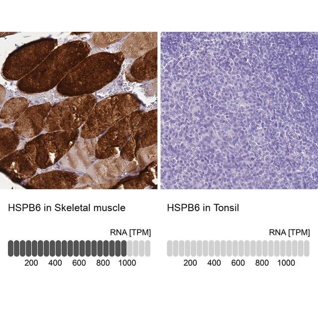 Anti-HSPB6 antibody produced in rabbit