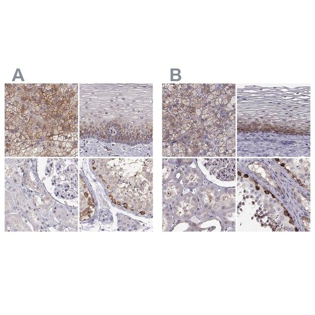 Anti-HSP90AB1 antibody produced in rabbit