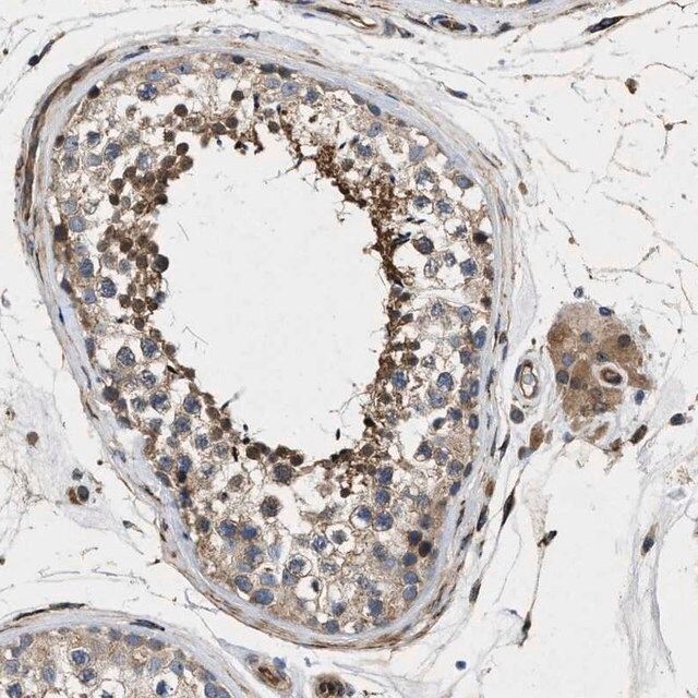 Anti-HSPA12B antibody produced in rabbit