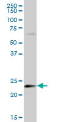 Anti-HSPB8 antibody produced in mouse