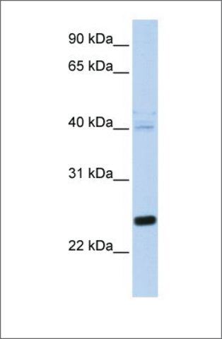 Anti-HSPB8 antibody produced in rabbit